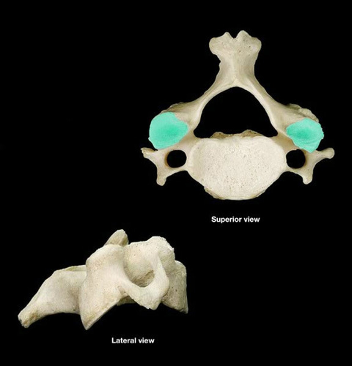 <p>Small, flat surfaces found on the superior side of the vertebrae found at the bilateral ends of the superior articular processes</p>