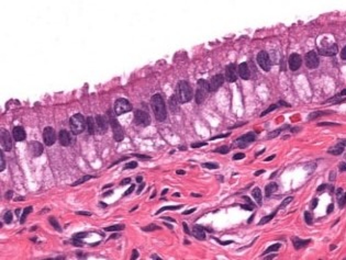 <p>lumen of the oviduct</p>