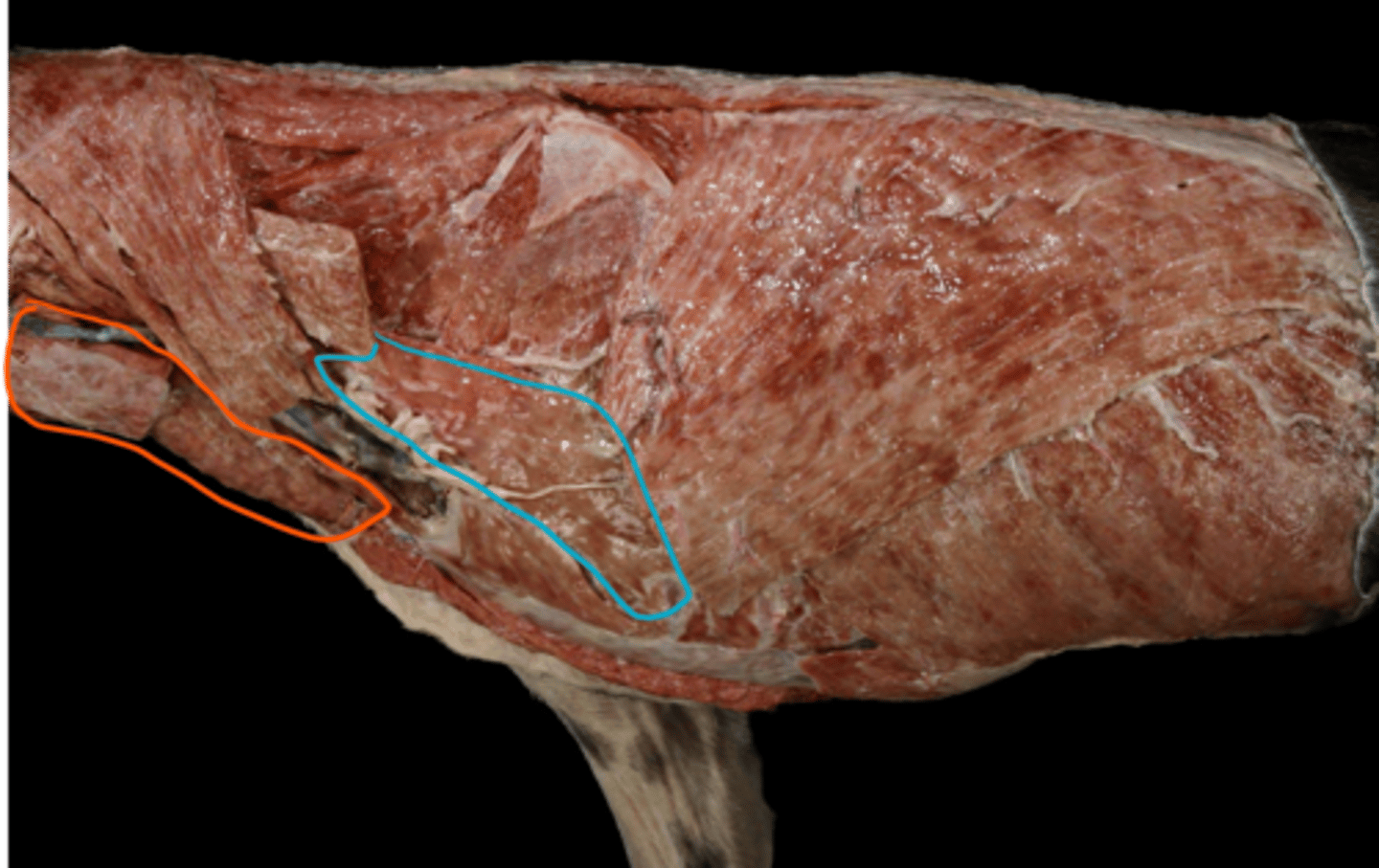 <p>identify these ventral muscles as they are seen superficially.</p>
