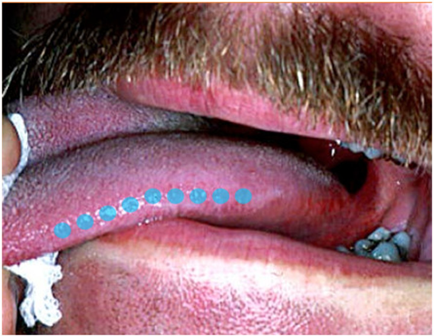 <p>Located on lateral surface (side) of tongue, some contain taste buds</p>
