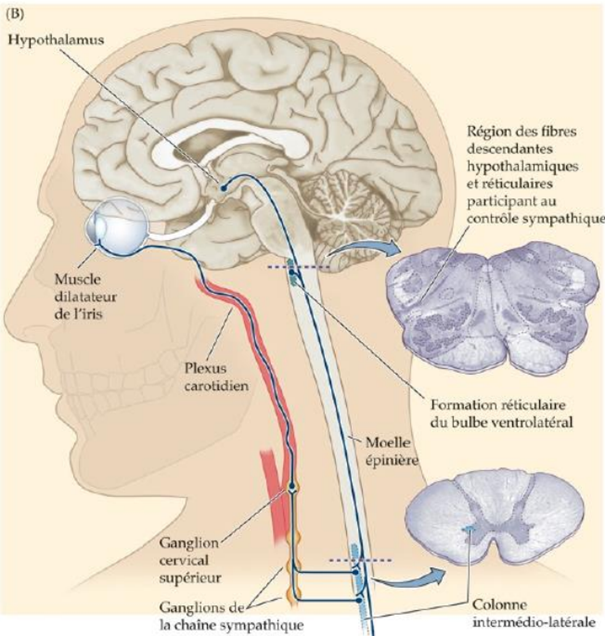 on observe des dysfonctionnement sur le trajet :
hypothalamus => formation réticulaire => neurones préganglionnaires sympathiques (colonne intermédio latérale TA-T3) => motoneurones des ganglions sympathiques (ganglion cervical supérieur)
et on observe une réduction du tonus (légère contraction permanente) sympathique :
-muscle dilatateur de l'iris = myosis
-tonus des muscles lisses de la paupière = ptosis
-tonus des muscles lisses du globe oculaire = énophtalmie
-tonus des vaisseaux cutanés = rougeur, hyperthermie
