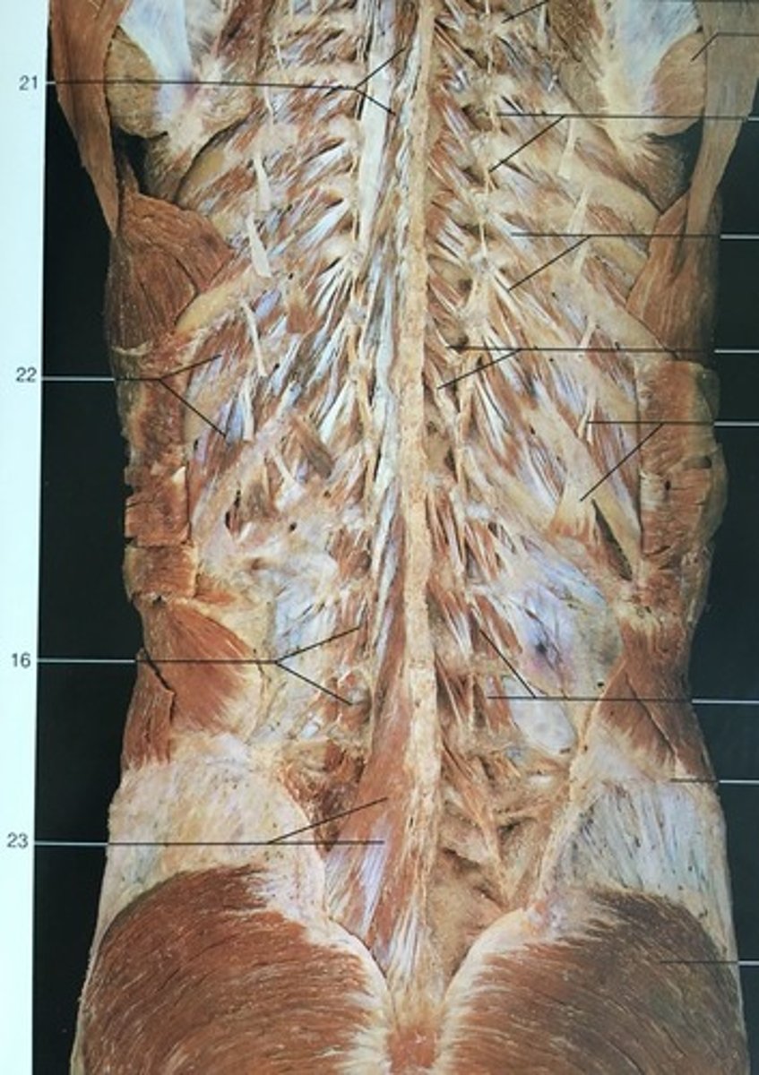 <p>extends (both sides), controls lateral flexion, and rotates (opposite side) the lumbar spine</p><p>#23</p>
