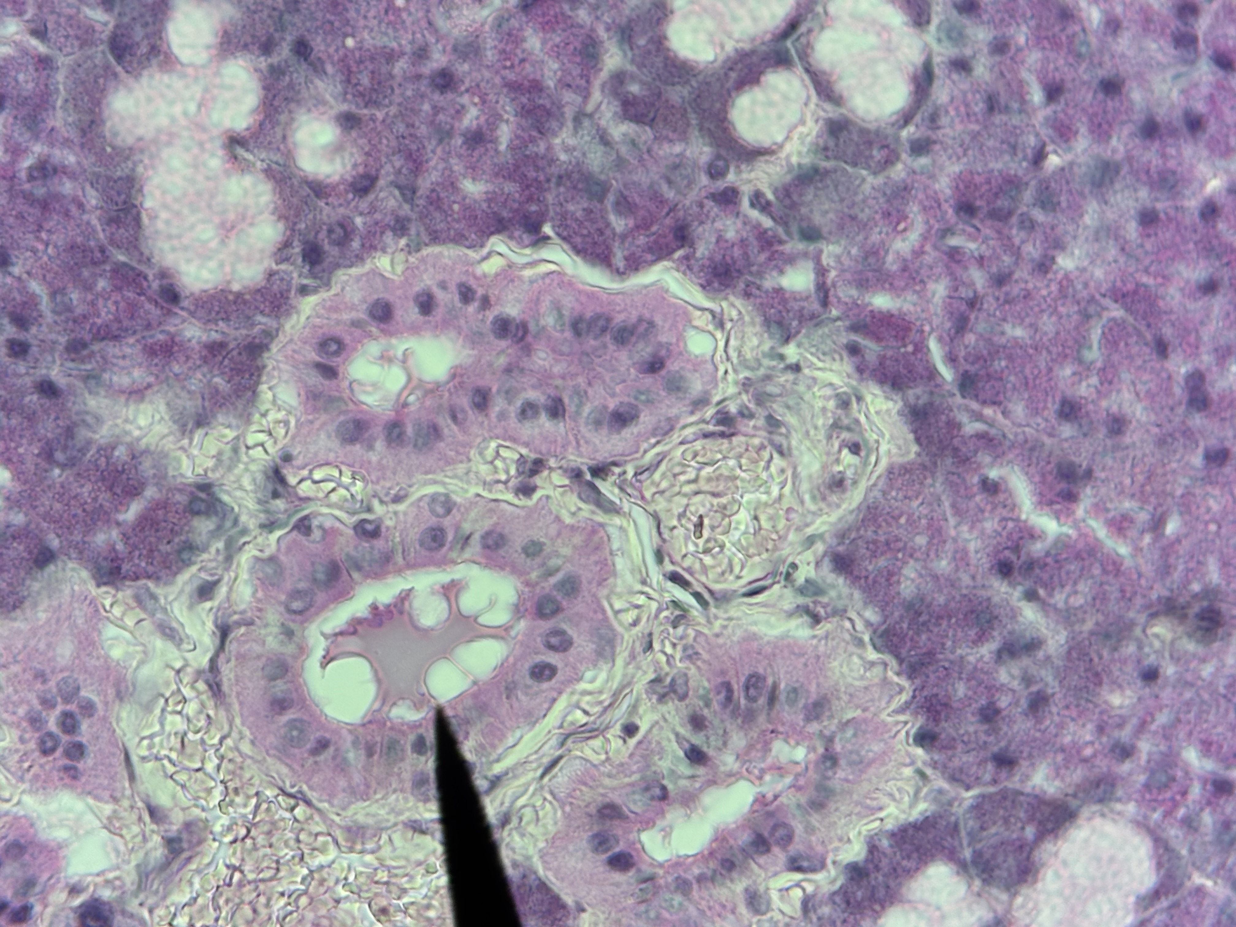 <p><span>Glandular ET - Exocrine</span></p>