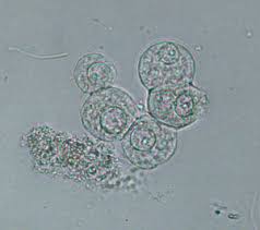 <ul><li><p>few present is normal</p></li><li><p>from the bladder, renal pelvis and urethra </p></li><li><p>central nucleus </p></li></ul><p></p>