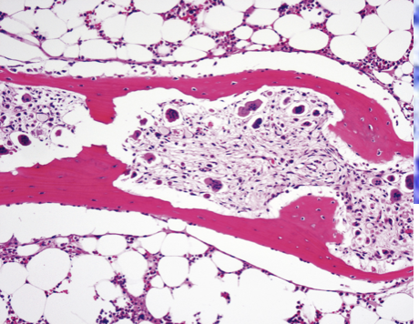 <p>What does this histo slide show?</p>