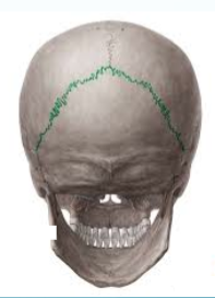 <p>name the <span style="font-family: sans-serif">suture in green</span></p>