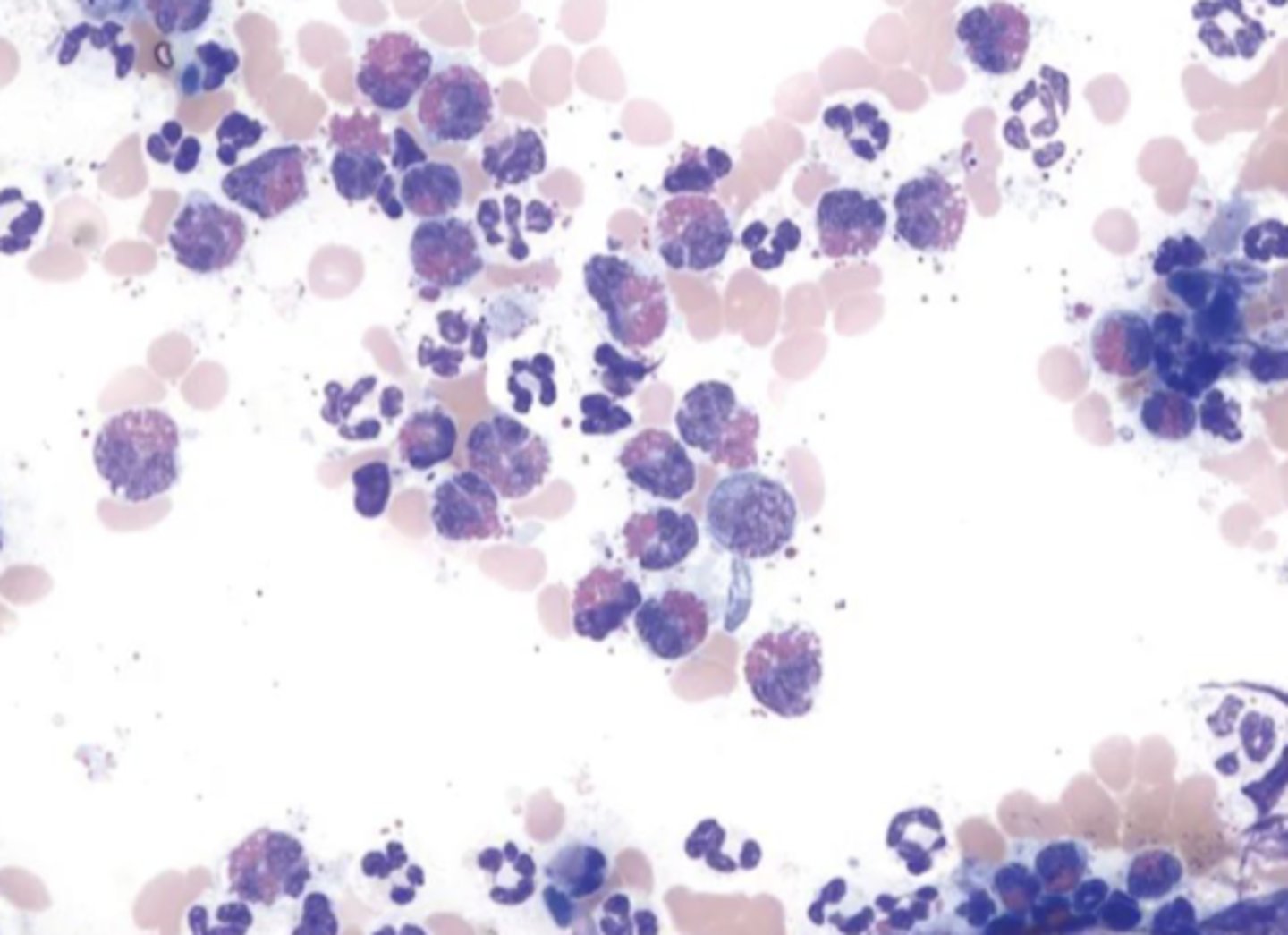 <p>What type of inflammation is this?</p>