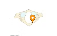 <p>The wide rounded arch on the posterior side of the C1 vertebrae - posterior tubercle is the bump</p>