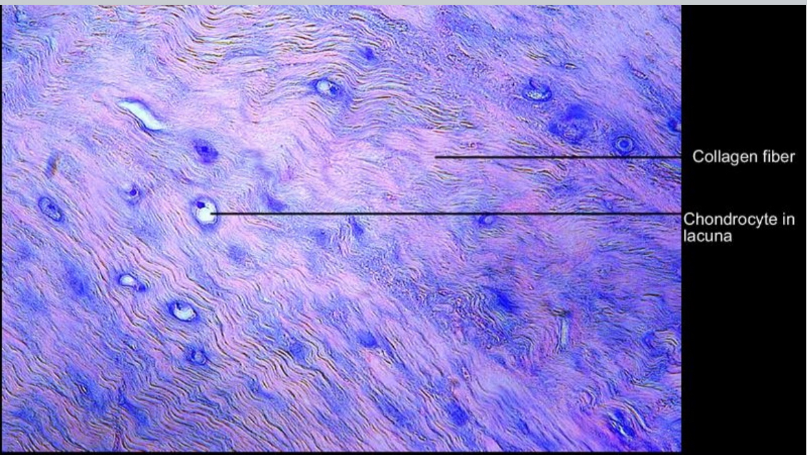 <ul><li><p>Parts of cells; nucleus and cytoplasm</p></li><li><p>Parts of tissues; lacuna, collagen fiber, matrix</p></li></ul><p></p>