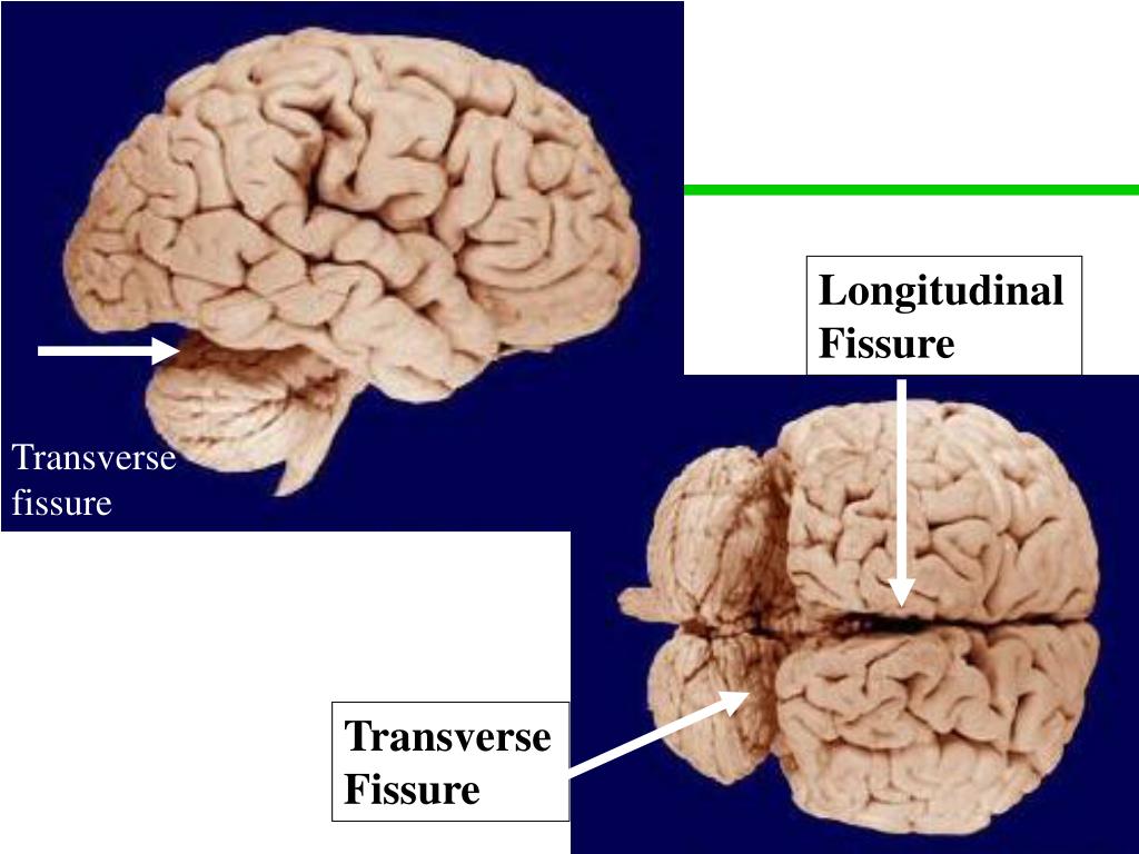 <p>What are longitudinal and transverse fissures?</p>