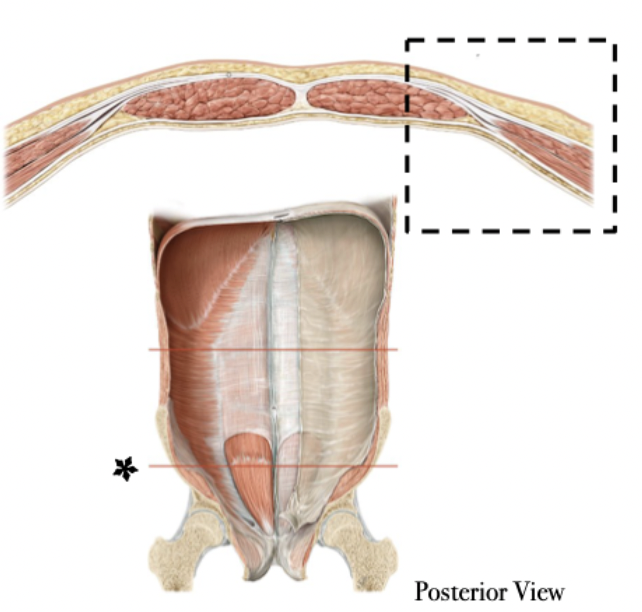 <p>Rectus Sheathe <u>below</u> the arcuate line</p>