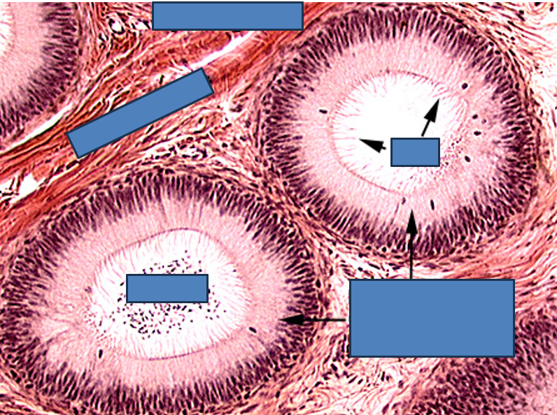<p>Identify this structure</p>