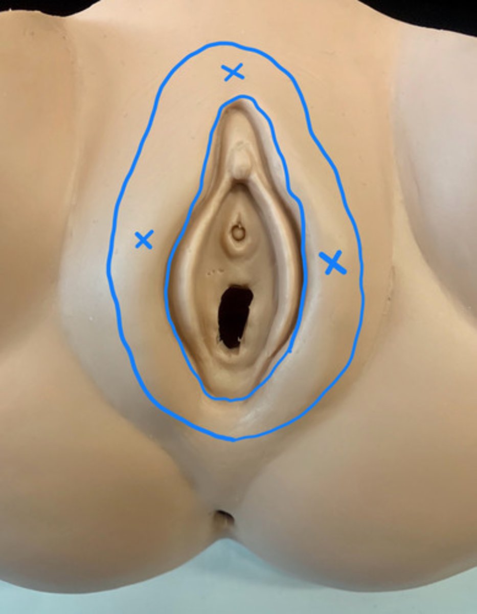 <p>ID the Area within the Blue Lines marked with the X's</p>