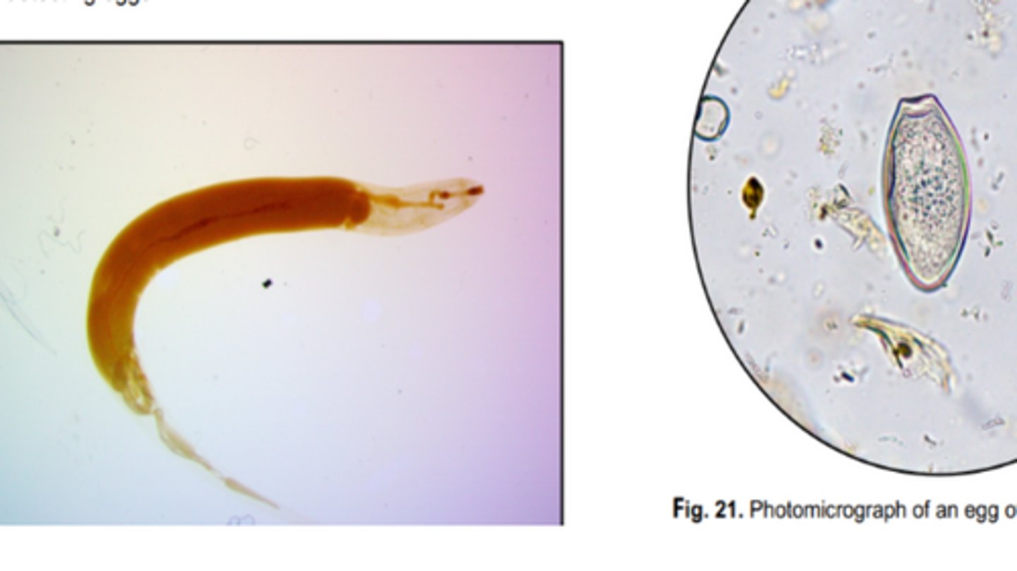 <p>Best method for detecting Oxyuris equi eggs (ovoid, yellowish, thick shelled, flattened, operculated)</p>