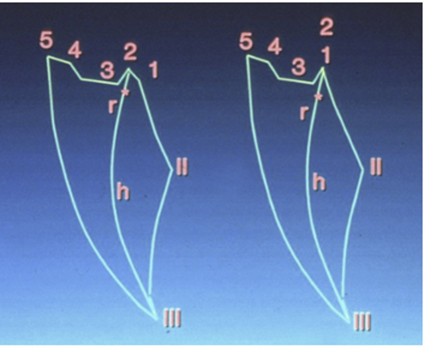 <p>in which diagram do MIP and CR not coincide</p>