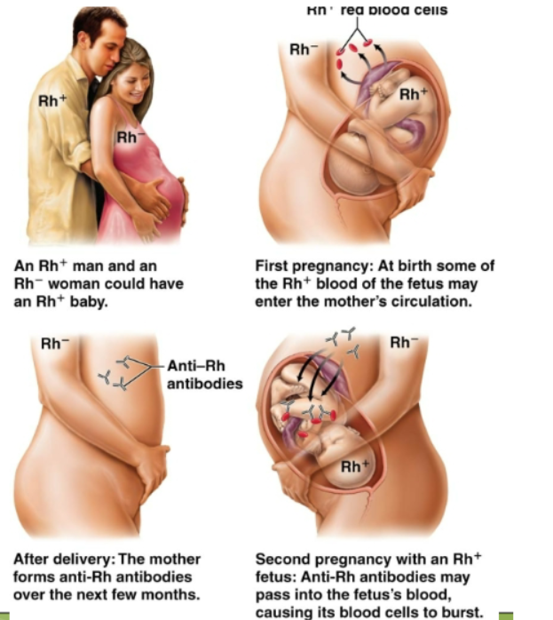 <p>First discovered on the resus monkey. Another important antigen. Individuals who lack these antigens are RH negative, individuals who have those on their RBCS are RH positive. RH negative people will not form Anti RH antibodies unless exposed through transfusion or given birth to RH positive babies. Also hemolytic disease of newborns.</p>