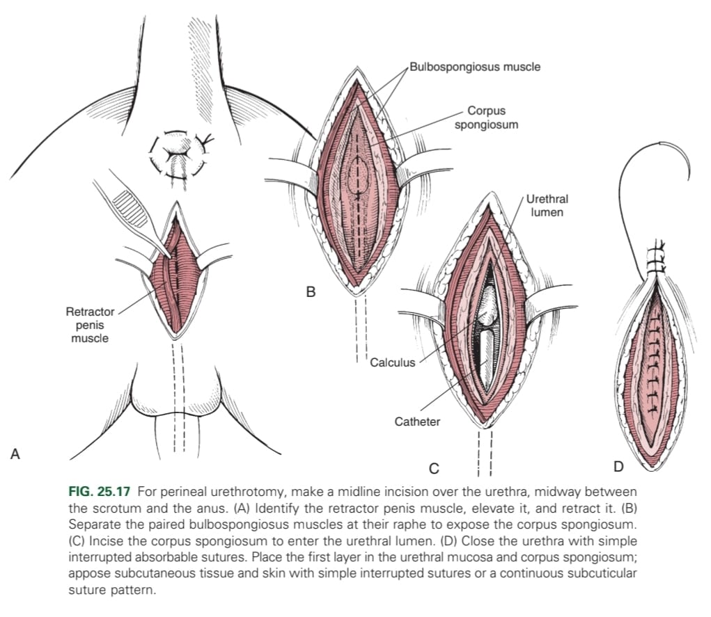 <p>Sternal recumbency → remove calculi at the level of the ischial arch</p>