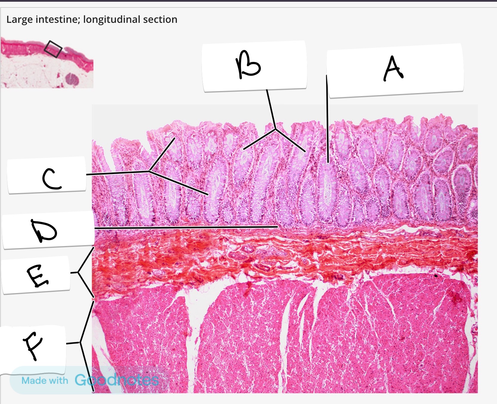 <p>What is the name of this organ</p>