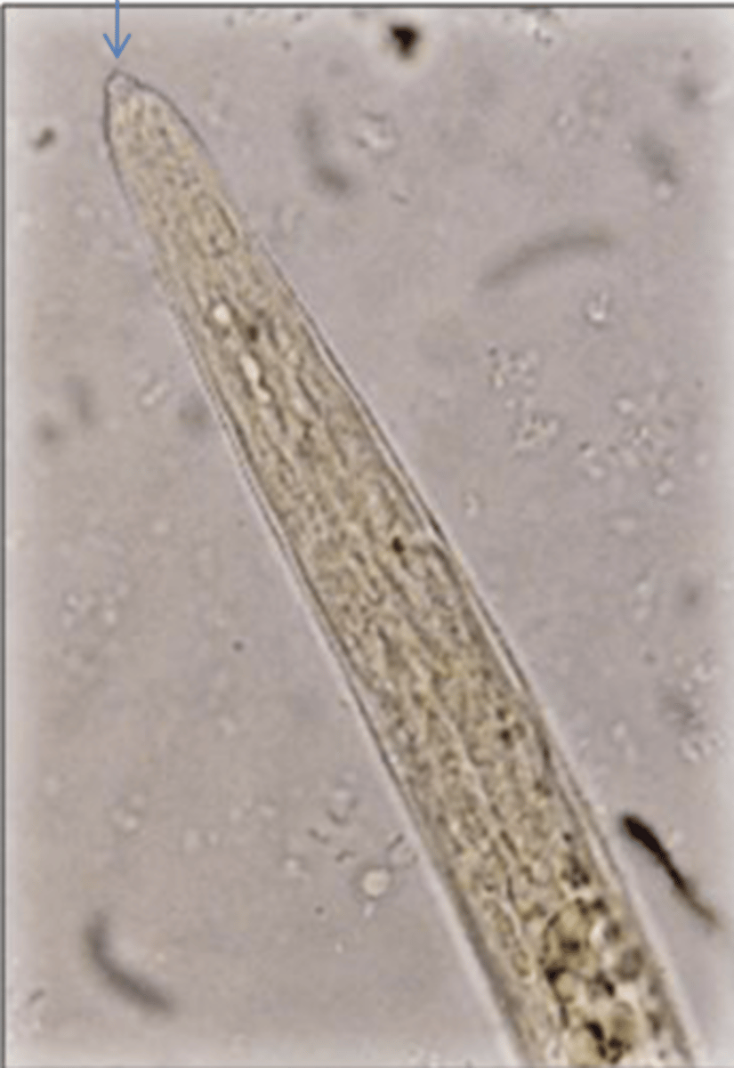 <p>What is this parasite? What characteristic/s did you use to identify it?</p>