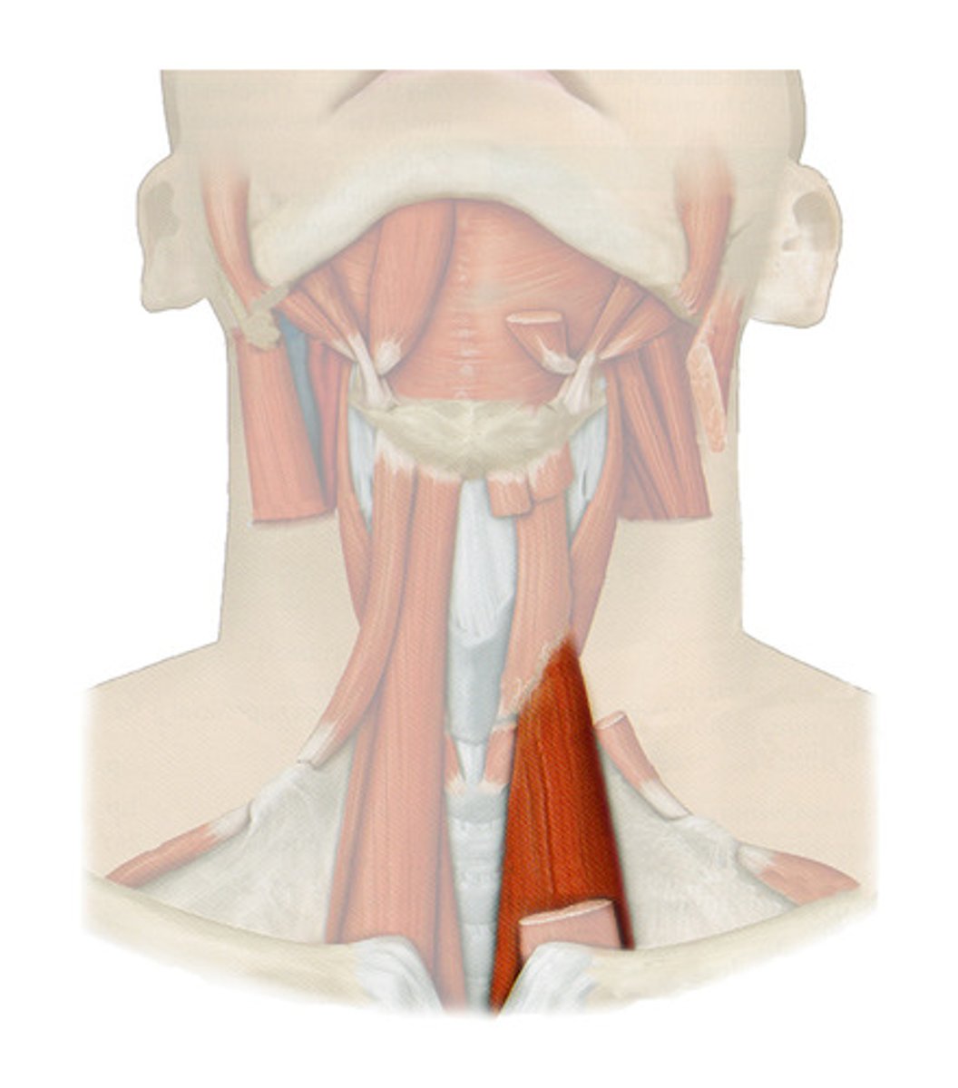 <p>What muscle is this?</p>