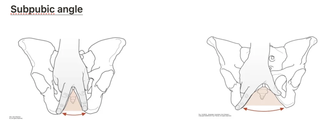 <p>The female pelvis has a larger subpubic angle, a broader pelvic inlet/outlet, and a greater distance between acetabula to facilitate childbirth.</p>