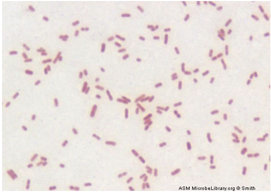 gram negative bacillus