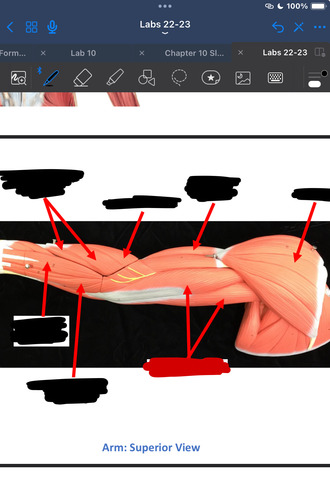 <p>What muscle is this?</p>