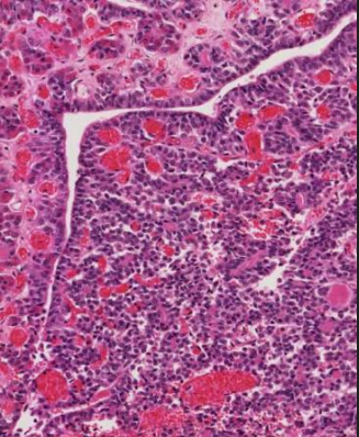 <p>Provides scaffold for the capillary network of the hypophyseal portal system</p><p></p><p>Capillaries in this gland are fenestrated, to enable passage of hormones from the secretory cells into the bloodstream</p><p></p><p>Cells form folding sheets (folds) and occasional cysts</p>