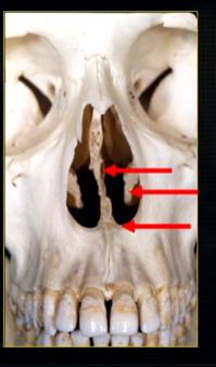 <p>what is the bottom arrow showing?</p>