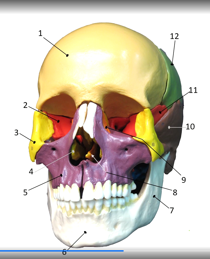 <p>Zygomatic Bone</p>
