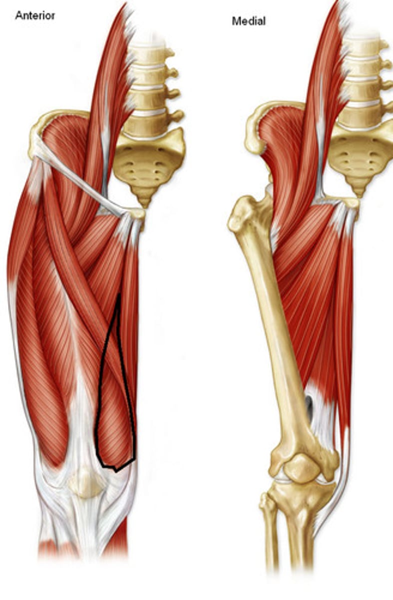 <p>Origin: intertrochanteric line and medial lip of linea aspera</p><p>Insertion: via common tendinous (quadriceps tendon) and independent attachments to base of patella; indirectly via patellar ligament to tibial tuberosity; tibia and patella via aponeorses (medial patella retinacula)</p><p>Innervation: femoral nerve (L2, <strong>L3, L4)</strong></p><p>Action: extends knee joint</p>