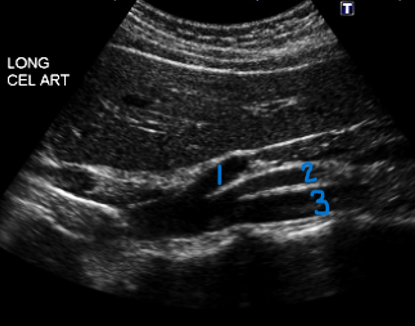<p>In this Sagittal view, what is #2?</p>