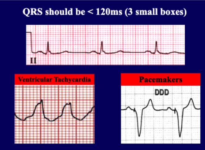 <p>&lt;120 ms (3 small boxes)</p>