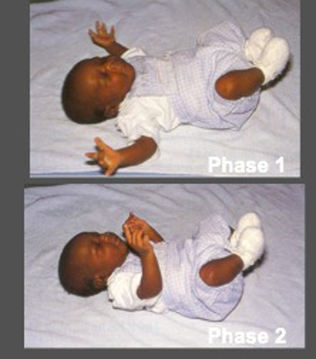 <p>Hold infant in hands &amp; lift few cm off surface, gently drop head into other hand, this should illicit startle reflex<br>head will throw back, hands open &amp; arms extend out to sides then retract in<br>disappears @ 2m</p>