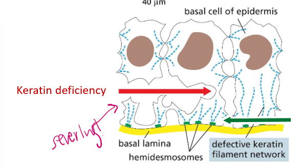 <p>If they mutate in the epithelia, the epidermis will detach from the lower layers of skin, creating terrible blisters. Because they bind to laminins (laminal proteins), they are bound by intergrin.</p>