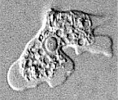 <p><strong>Identify parasite/stage, mention the examined sample, and name the disease induced by this parasite in the CNS.</strong></p><div data-type="horizontalRule"><hr></div><p><strong>Mention the culture media you can use to confirm the diagnosis.</strong></p><div data-type="horizontalRule"><hr></div><p><strong>Mention the stain used and two morphological characteristics of this stage.</strong></p><div data-type="horizontalRule"><hr></div><p><strong>Identify another sample that can be used to detect this stage.</strong></p>