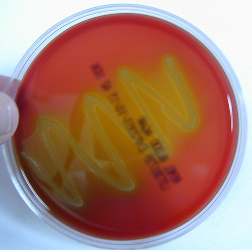 What kind of hemolysis is this?