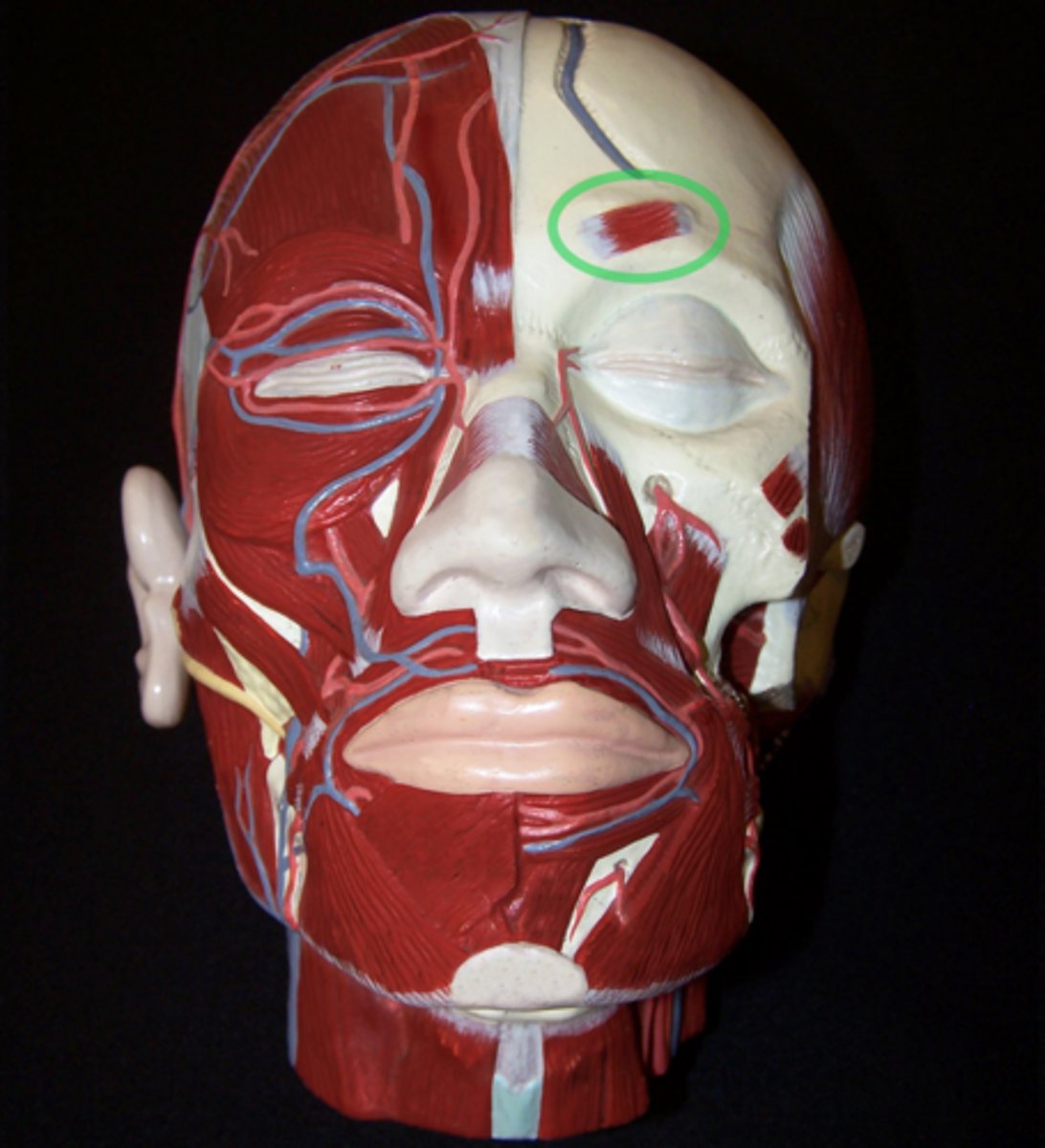<p>Deep side; where eyebrow would go. Eyebrow muscle under frontal belly of occipitofrontalis.</p>