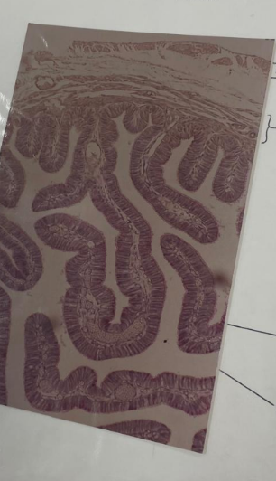 <p>what is this? what epithelial cells can you see?</p>
