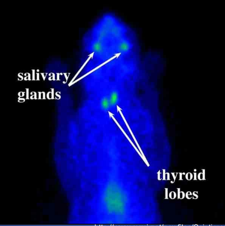 <p>describe the scintigraphy </p>