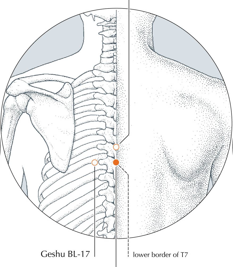 <p>DU-9</p>