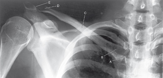 <p>label the anatomy accordingly A-E, the projection/part, and rotation if applicable </p>