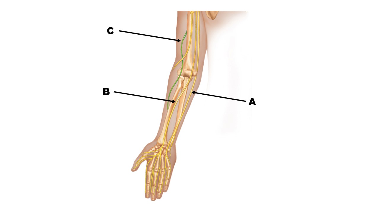 <p><span>The nerve at the tip of arrow A is the _______ nerve.</span></p>