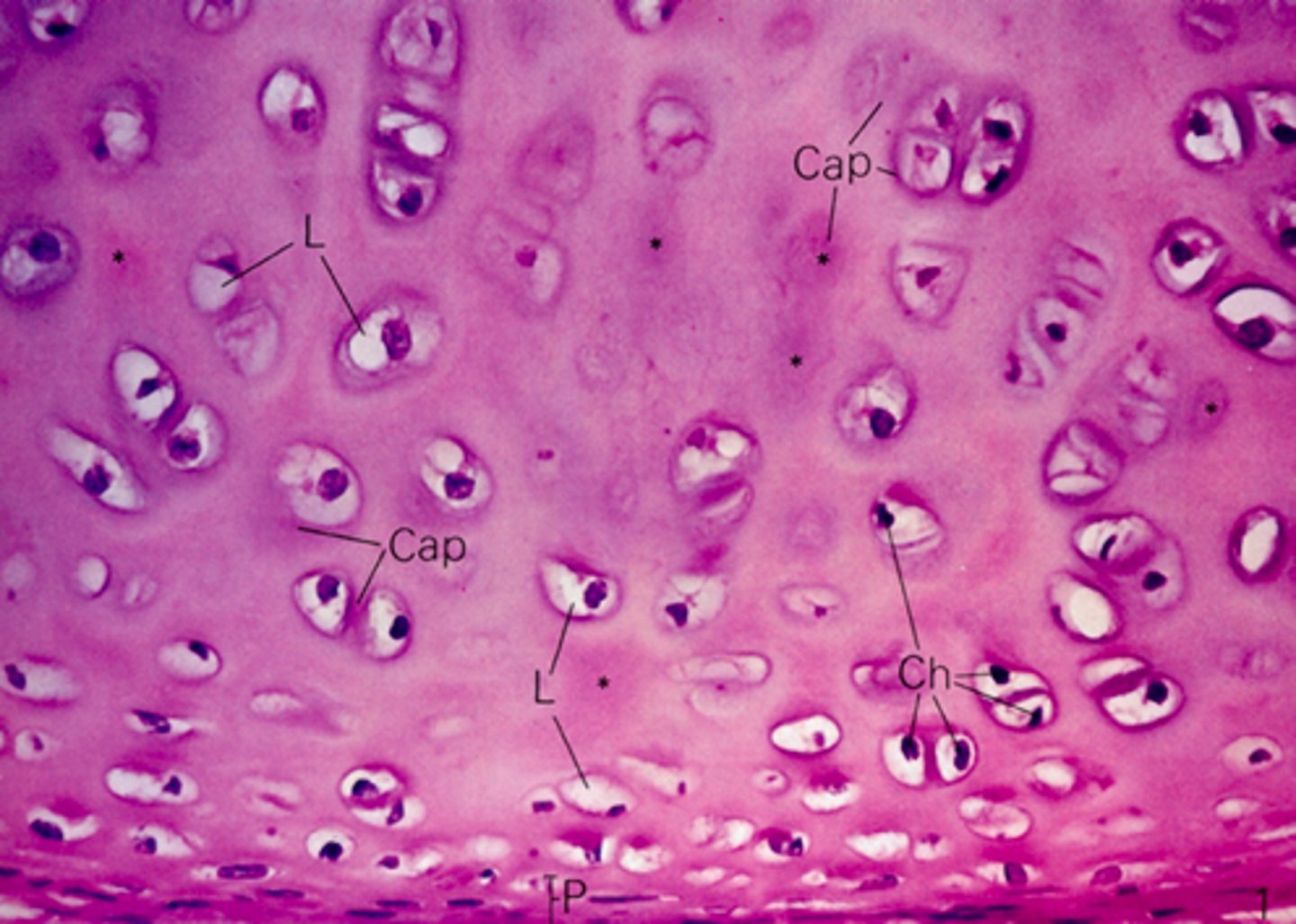 <p>identify the cartilage:</p>