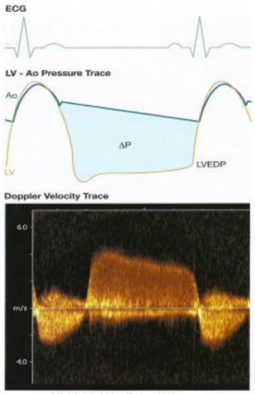 <p>Because the pressure difference gradually decreases as the AR slowly moves back through the closed AOV into the LV.</p>
