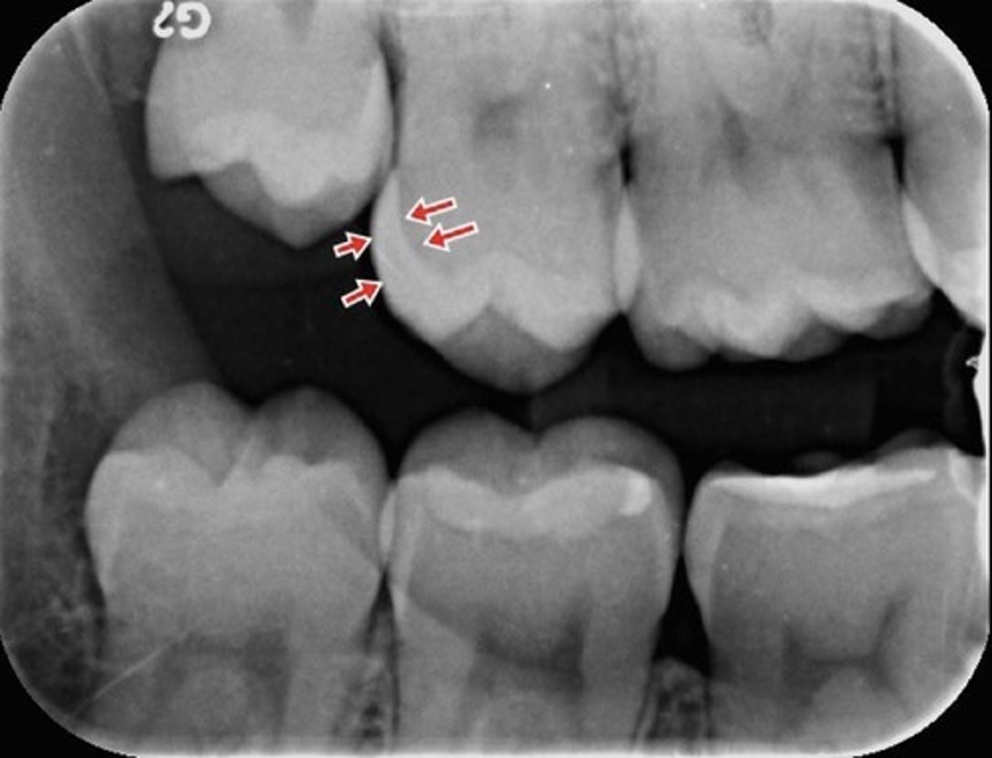 <p>What is the arrow pointing to?</p>