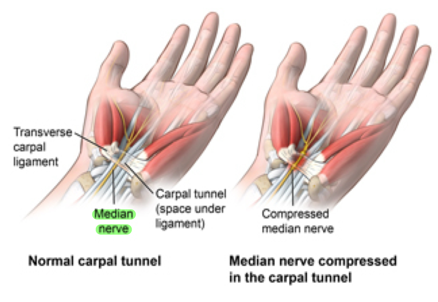 <p><strong><em>“Pop/Crack a joint = SOUND? = Gases escaping the joint&nbsp;</em></strong></p><ul><li><p>Left knee buckling is not the same kind of popping&nbsp;</p></li></ul><p></p>