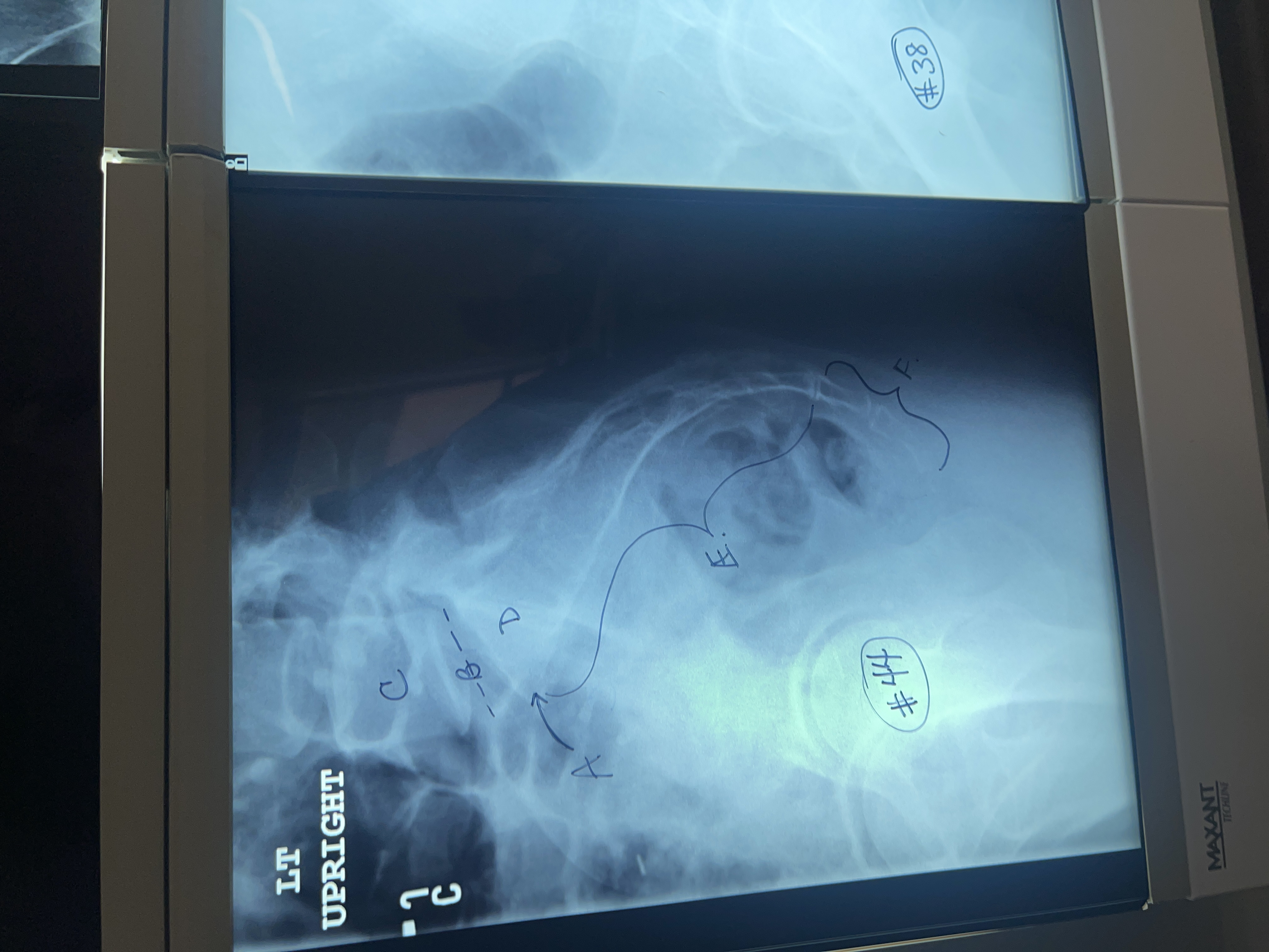 <p>Label # 44 lateral sacrum/ coccyx</p>
