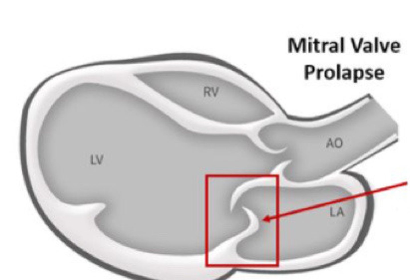 <p>What is represented by this image</p>