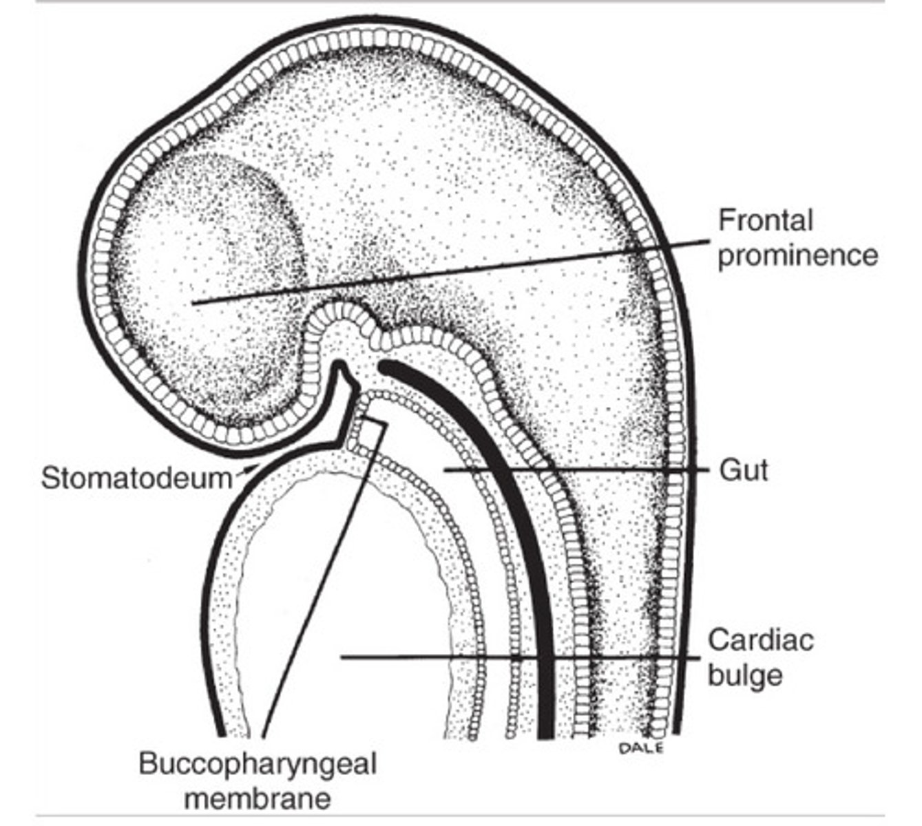 <p>Results in head development</p><p>Elongation brings only ectoderm</p><p>There is no mesoderm above the pituitary stalk</p>